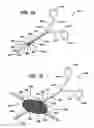 Fig. 07 - Method and means to attach anchor suture onto mesh implants