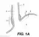 Fig. 02 - Methods for fastening tissue