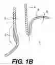 Fig. 03 - Methods for fastening tissue