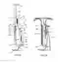Fig. 03 - Delivering bioabsorbable fasteners