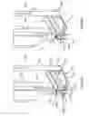 Fig. 07 - Delivering bioabsorbable fasteners
