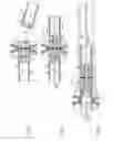 Fig. 05 - Implanted magnets retrieval system and method