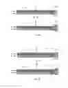 Fig. 05 - Methods, devices and systems for filling body cavities