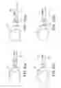 Fig. 15 - Method for forming non-circular cartilage grafts