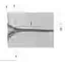 Fig. 13 - Method of attaching a mesh to a coated loop member of a surgical snare device
