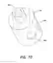 Fig. 14 - Methods and apparatus for removing material from within a mammalian cavity using an insertable endoscopic instrument