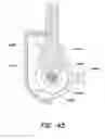 Fig. 66 - Methods and apparatus for removing material from within a mammalian cavity using an insertable endoscopic instrument