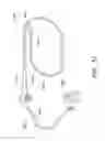 Fig. 72 - Methods and apparatus for removing material from within a mammalian cavity using an insertable endoscopic instrument