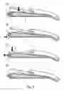 Fig. 03 - Device for chemically assisted dissection