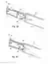 Fig. 08 - Device for chemically assisted dissection