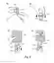 Fig. 16 - Device for chemically assisted dissection