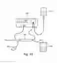 Fig. 18 - Device for chemically assisted dissection