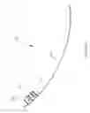 Fig. 06 - Flexible surgical device for tissue removal