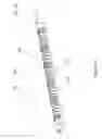 Fig. 07 - Flexible surgical device for tissue removal