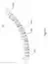 Fig. 09 - Flexible surgical device for tissue removal