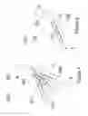 Fig. 11 - Flexible surgical device for tissue removal