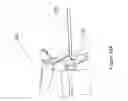 Fig. 14 - Flexible surgical device for tissue removal