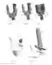 Fig. 06 - Orthopedic stabilization devices and methods for installation thereof