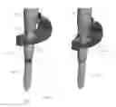 Fig. 14 - Orthopedic stabilization devices and methods for installation thereof