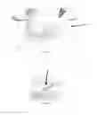 Fig. 19 - Orthopedic stabilization devices and methods for installation thereof