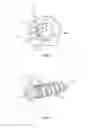 Fig. 03 - SURGICAL IMPLANT SYSTEM AND METHOD