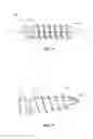 Fig. 04 - SURGICAL IMPLANT SYSTEM AND METHOD