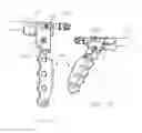 Fig. 33 - Method of implanting a bone plate