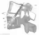 Fig. 01 - Process for introducing a stabilizing element into a vertebral element