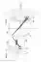 Fig. 03 - Process for introducing a stabilizing element into a vertebral element