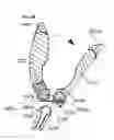 Fig. 13 - Process for introducing a stabilizing element into a vertebral element