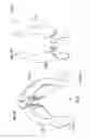 Fig. 15 - Process for introducing a stabilizing element into a vertebral element