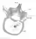 Fig. 22 - Process for introducing a stabilizing element into a vertebral element