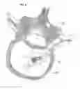 Fig. 23 - Process for introducing a stabilizing element into a vertebral element