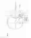 Fig. 29 - Process for introducing a stabilizing element into a vertebral element