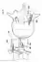 Fig. 30 - Process for introducing a stabilizing element into a vertebral element