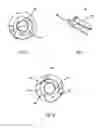Fig. 04 - Intramedullary compression screw system