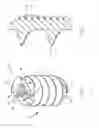 Fig. 05 - Intramedullary compression screw system