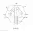Fig. 07 - Hammertoe implant and instrument