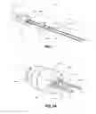 Fig. 02 - Implant retaining loop and guide wire extension