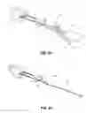 Fig. 04 - Implant retaining loop and guide wire extension