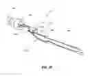 Fig. 05 - Implant retaining loop and guide wire extension