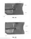 Fig. 08 - Implant retaining loop and guide wire extension