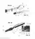 Fig. 11 - Implant retaining loop and guide wire extension