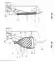 Fig. 02 - Systems and methods for cryoablation of a tissue