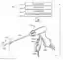 Fig. 01 - Medical ablation system and method of use