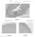 Fig. 05 - Methods, systems and devices for reducing the luminal surface area of the gastrointestinal tract