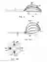 Fig. 10 - Basket catheter with deflectable spine