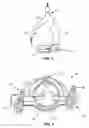 Fig. 05 - Single port laparoscopic access system with external tool support