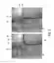 Fig. 03 - Assisting apparatus for assisting a user during an interventional procedure