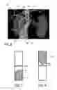 Fig. 05 - Assisting apparatus for assisting a user during an interventional procedure